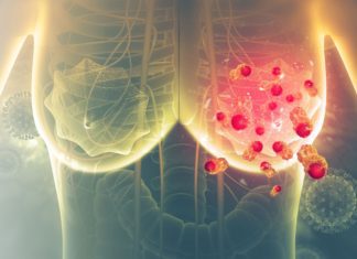 From Data to Cancer: How Can AI Help Save Lives
