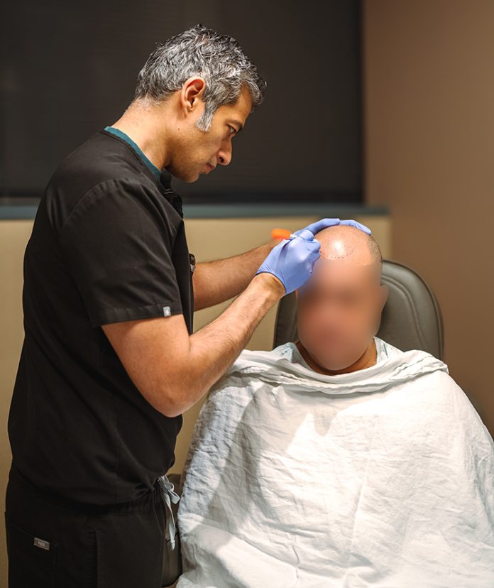 hairline-transplant-patient