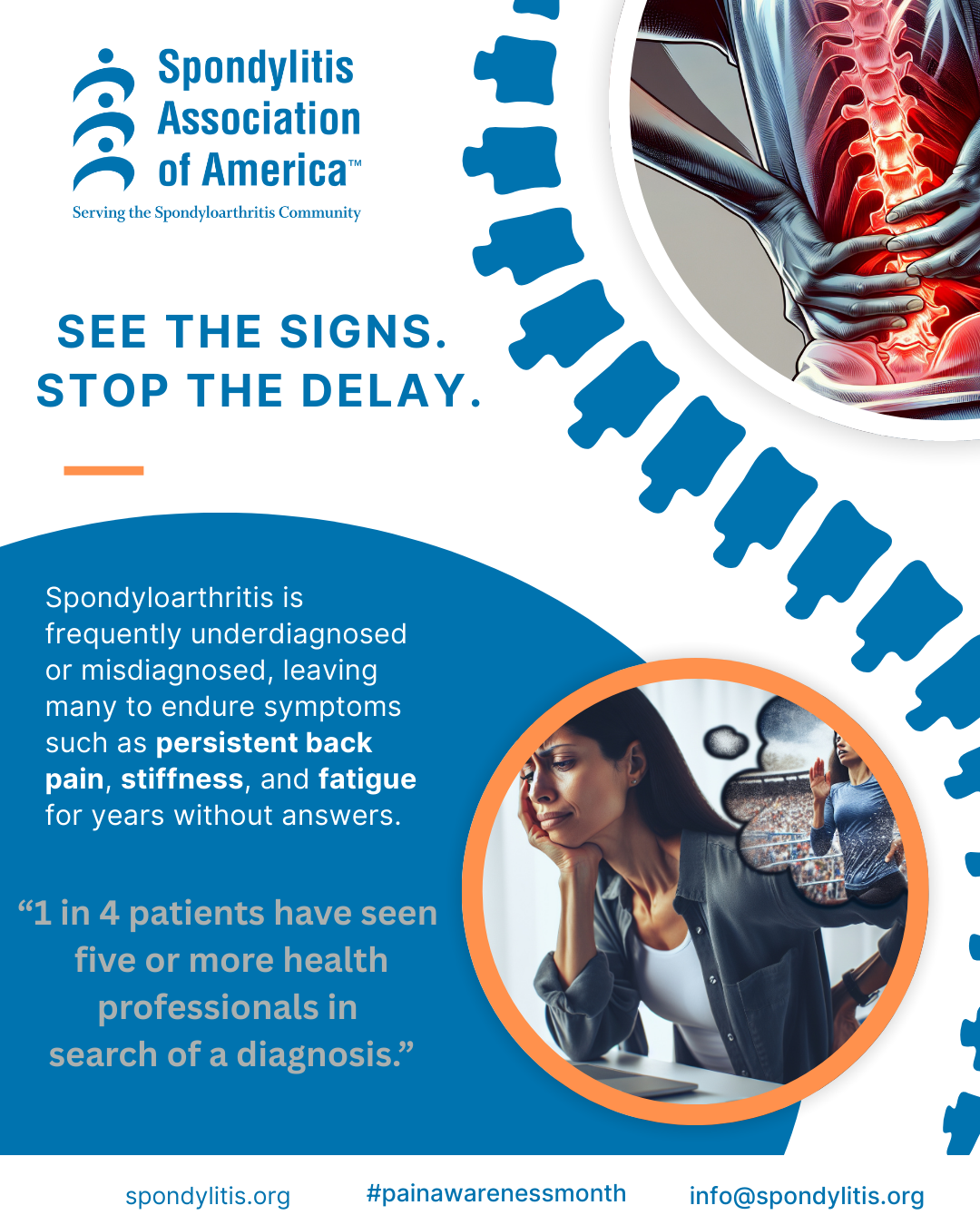 Spondylitis Association of America Launches “See the Signs. Stop the Delay.”  National Awareness Campaign to Reduce Misdiagnosis and Delays in Spondyloarthritis Care